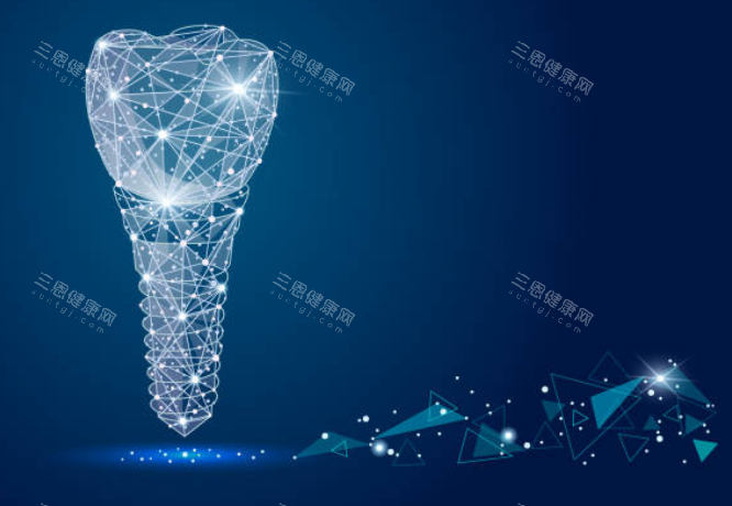 种植牙模拟图示意图