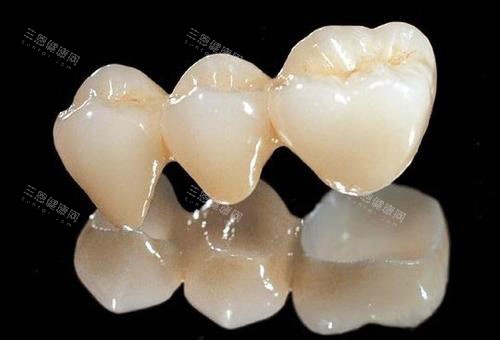 進口全瓷牙冠哪個牌子好？分享2025年受歡迎品牌名單和價格！