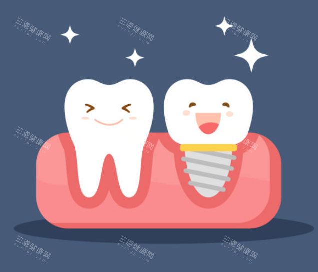 分析種牙瑞士和歐美區別看種點揀好？從材質、價格同使用年限三大關鍵看邊款更啱香港人？