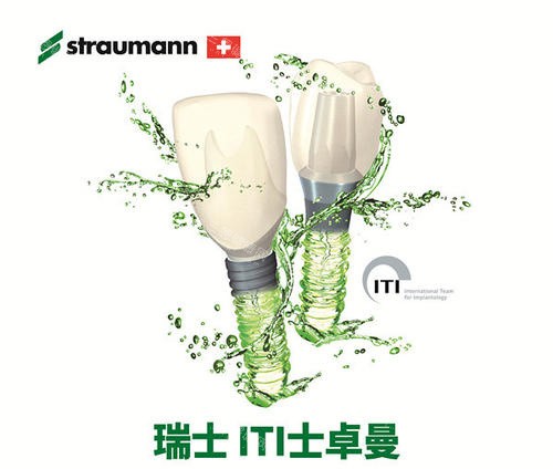 瑞士ITI屬於什麽檔次？從四級純鈦到五級鈦鋯合金解析高端種植體的20年使用壽命支持