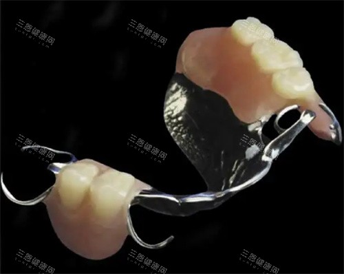 鑲牙香港邊家強？老牌牙醫教你揀烤瓷/全瓷/活動假牙附價錢參考表！