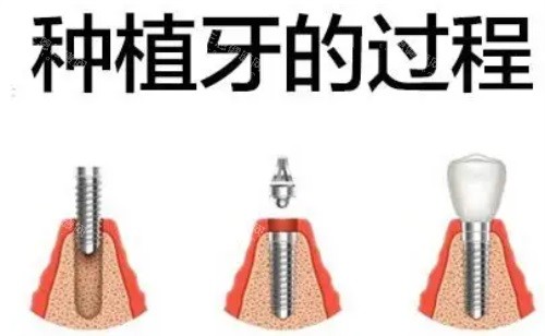 香港大學深圳醫院牙科好唔好？睇牙優勢同口碑一次過話你知！