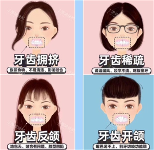香港箍牙價錢貴嗎？一文睇清金屬托槽同隱形矯正價錢