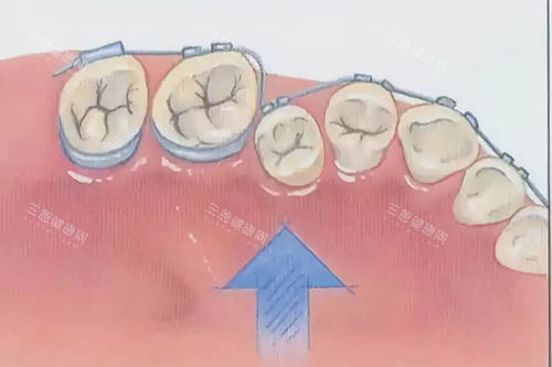 深圳愛康健口腔醫院地址：羅湖區建設路羅湖火車站大樓C區！預約6130/營業至18點/睇牙方便！