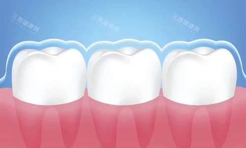 深圳諾德種牙點解咁受歡迎？技術、醫生、價錢全揭秘！