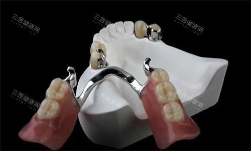 吸附性義齒靠譜嗎？分享香港做義齒修復特點和收費標準！