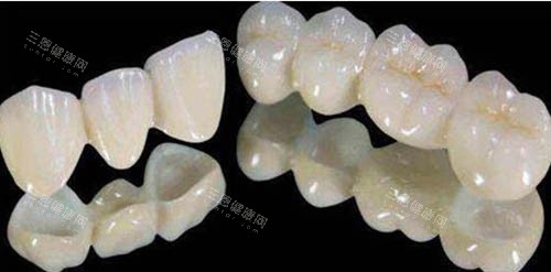 全瓷牙和二氧化鋯牙咋選？從材質、強度、價格和美觀度看有啥大區別