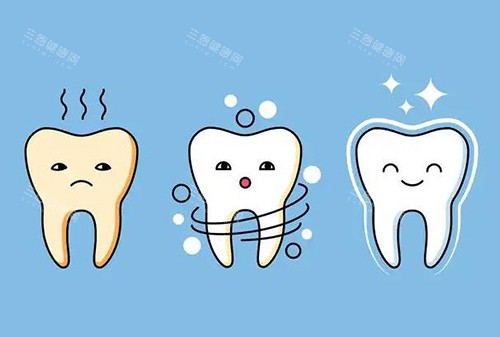 牙齒冷光美白靠譜嗎？分享原理特點改善明顯收費也不貴！
