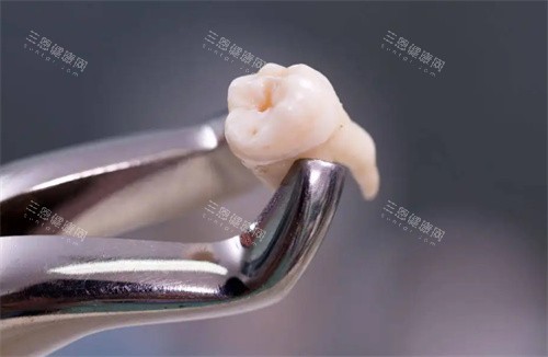 玉紅口腔拔牙多少錢？2025玉红口腔拔牙价目表公开！普通牙200元起/智齿320元起，收费透明！
