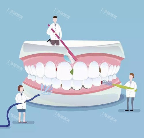 洗牙手術原理大揭秘：超聲波與手工刮治如何深度清除牙結石？