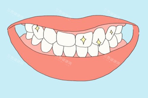 術後72小時關鍵期：做完冷光美白如何護理才能讓結果維持3年以上？