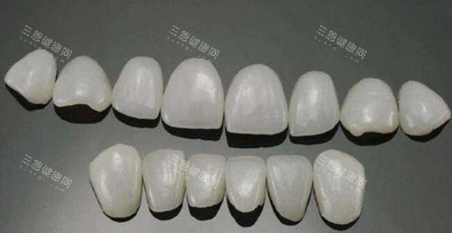 深圳柏齒康口腔瓷贴面修复改善
