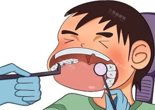 深圳兒科牙醫揭秘：埋伏多生牙“超聲骨刀小創口術”如何避開恒牙胚？