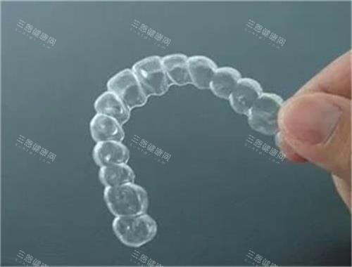 箍牙階形牙套要戴幾耐？從初診到收工全時間線大公開！