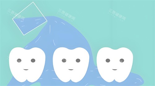 洗牙