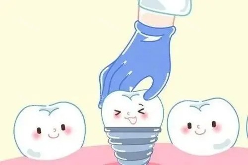 北上种牙5大风险！热心网友分享：‘$5000一口价’可能用二手种植体
