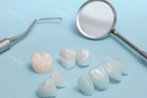 愛爾創全瓷牙冠多少錢一顆？查詢在香港安裝一顆愛爾創全瓷牙價格