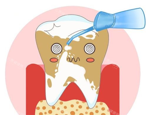 牙齒黃黃的咋整？冷光、牙貼、洗牙哪種靠譜？結合結果可靠性來分析
