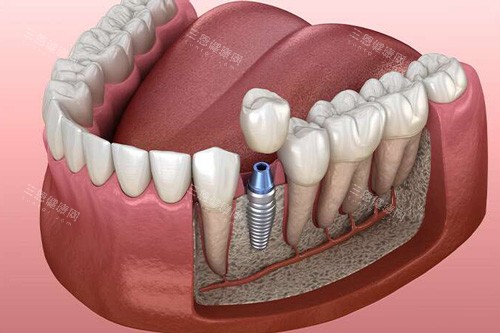 深圳歐牙拜爾口腔係正規嘅嗎？親身驗過：地址民治大道660號+簡介逐樣講