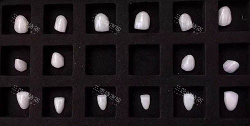 陶瓷美白貼片價格大公開​！國產、韓國進口、歐洲進口陶瓷貼片價格