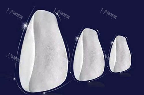 牙贴片 牙贴片