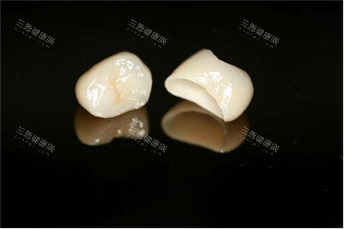 全瓷冠價格公開​！全瓷冠牙齒一顆多少錢？
