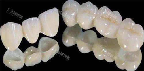 全瓷冠牙齦變黑？牙齦變黑嘅原因+點樣處理同預防