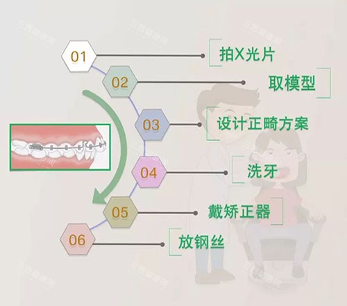 深圳口碑好的牙科排名曝光！麥芽、格倫菲爾等5間上榜！