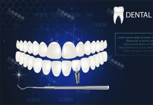 牙齿卡通图示CJ图 牙齿卡通图示CJ图