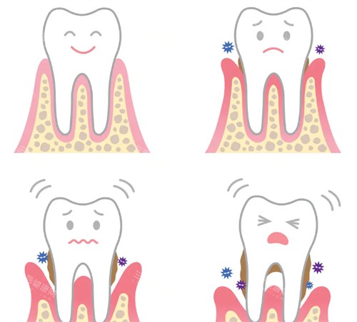 牙齿松动解决办法 牙齿松动解决办法