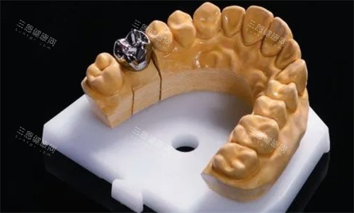 深圳海德口腔價格大揭秘！2025全新收費表含種植牙、矯正、美白等項目詳情！