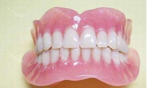 吸附性义齿照片 吸附性义齿照片