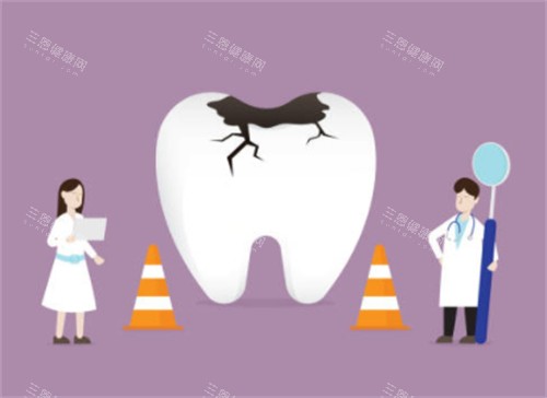 牙齿破损示意图 牙齿破损示意图