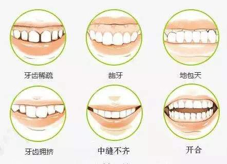 深圳鬥芽口腔交通指南：地鐵4號線附近，金屬自鎖托槽10800元！ 