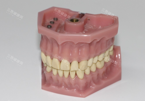 全口假牙
