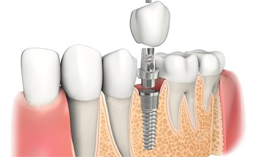 深圳恆一粵美口腔怎麼樣正規不？從醫院實力|醫生技術|收費|口碑方面剖析其正規性