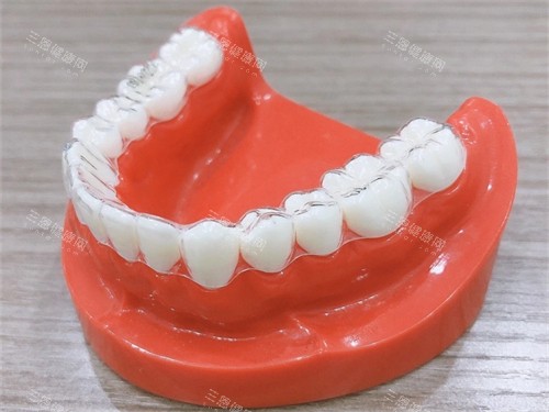 牙齿矫正隐形牙套模型图 牙齿矫正隐形牙套模型图