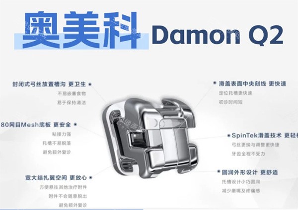 奥美科DamonQ2金属自锁牙套 奥美科DamonQ2金属自锁牙套