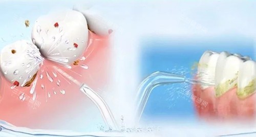 深圳青檸檬口腔2025收費標準：基礎治療|綜合治療|個性化治療項目價格明細！