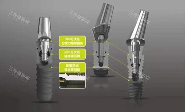 百康特种植牙怎么样