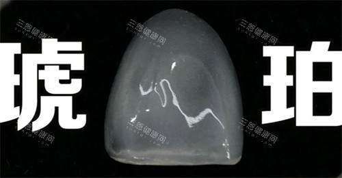 琥珀瓷贴面