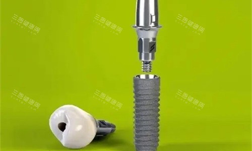 植体产品展示图 植体产品展示图