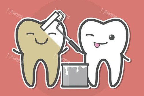 牙黄牙齿美白展示 牙黄牙齿美白展示