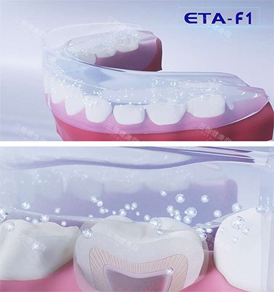ETA牙齿矫正器 ETA牙齿矫正器