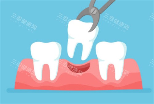 想了解拔牙補牙價格，地點香港、深圳！港深拔牙补牙价目：普通牙500vs150，智齿2000vs350起！