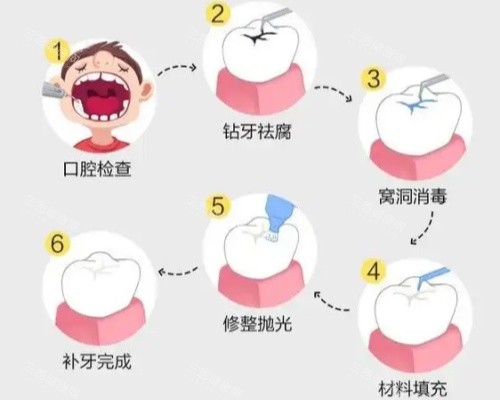​​香港補牙和內地有啥區別？價格貴一倍，材料技術有差異，看完再選