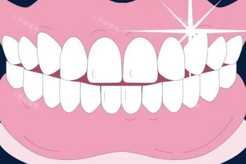 整齐牙齿卡通图 整齐牙齿卡通图