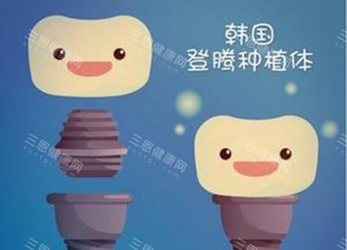 登腾种植体 登腾种植体