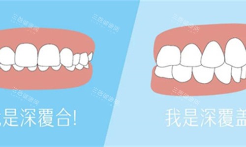 牙齿深覆合展示对比 牙齿深覆合展示对比