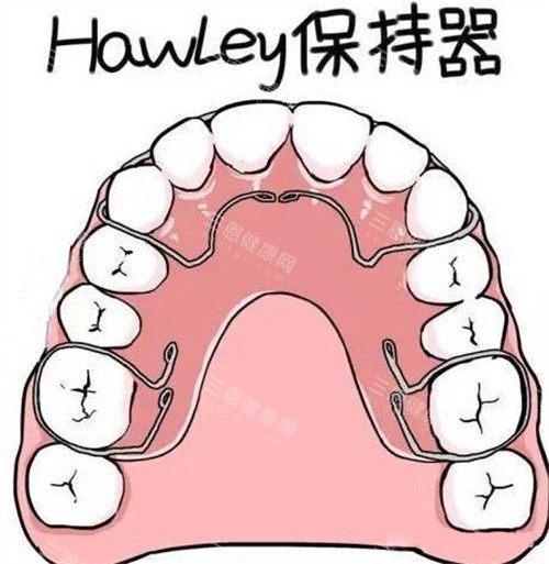 牙齿矫正Hawley哈雷保持器 牙齿矫正Hawley哈雷保持器